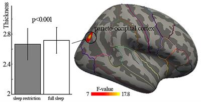 Cortical Thinning and Abnormal Structural Covariance Network After Three Hours Sleep Restriction